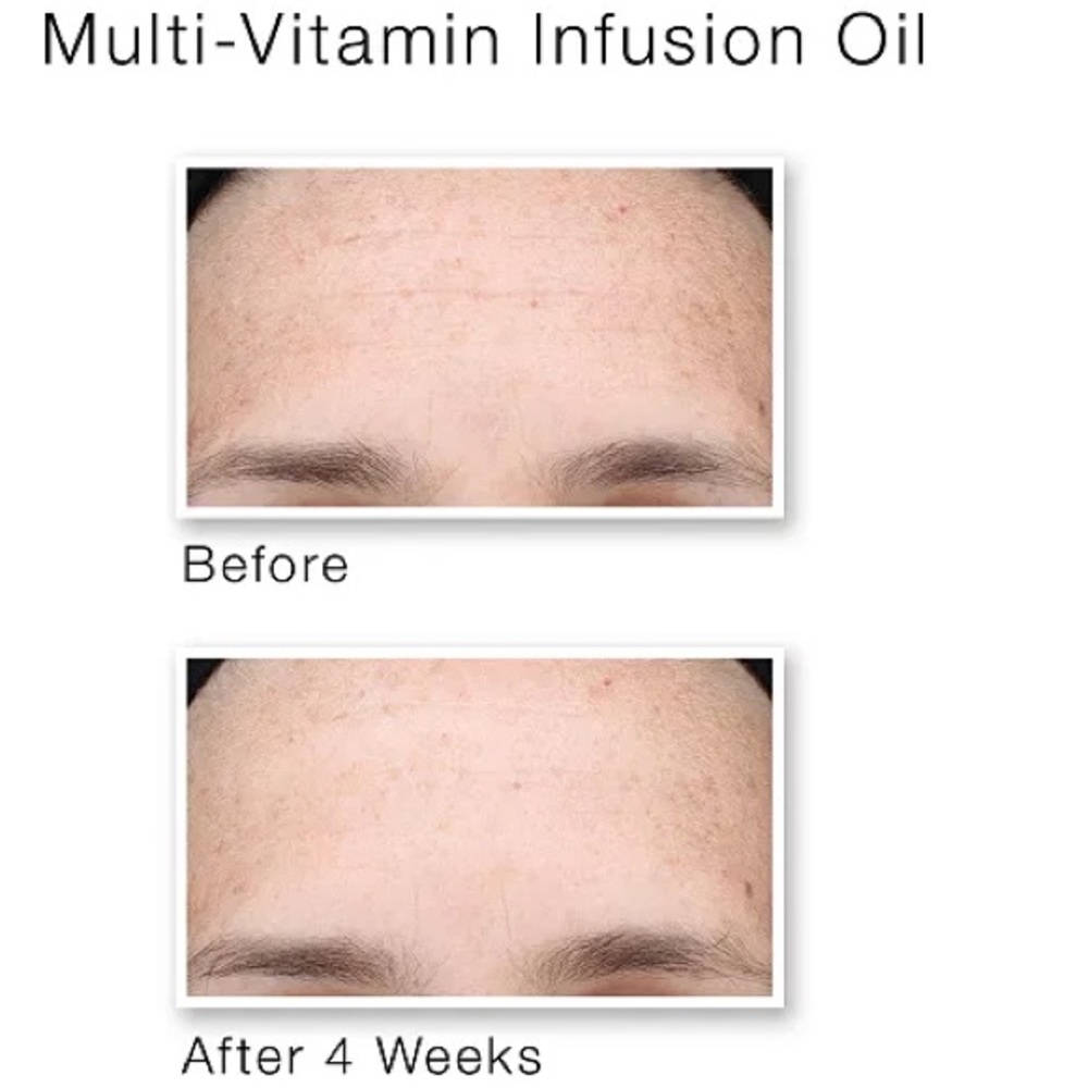 Murad’s Hydrate Trial Kit - Picture 5 of 5